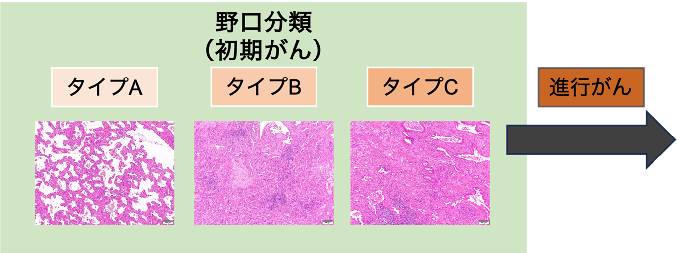 図1野口分類.png